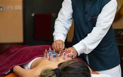 Cupping